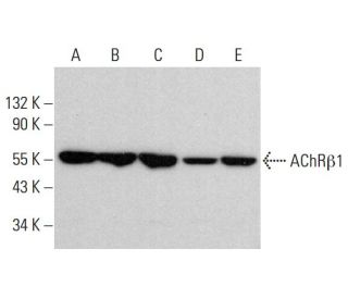 Nicotinic Acetylcholine Receptor beta 1/CHRNB1 Antibody (118) - Western Blotting - Image 383214 