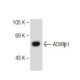 Nicotinic Acetylcholine Receptor beta 1/CHRNB1 Antibody (170) - Western Blotting - Image 109800