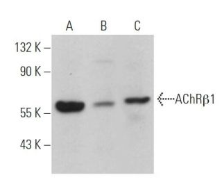 Nicotinic Acetylcholine Receptor beta 1/CHRNB1 Antibody (170) - Western Blotting - Image 363986 