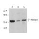 Nicotinic Acetylcholine Receptor beta 1/CHRNB1 Antibody (170) - Western Blotting - Image 363986 