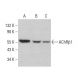 Nicotinic Acetylcholine Receptor beta 1/CHRNB1 Antibody (170) - Western Blotting - Image 383212 