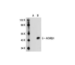 Nicotinic Acetylcholine Receptor beta 1/CHRNB1 Antibody (73) - Western Blotting - Image 19865
