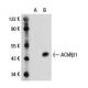 Nicotinic Acetylcholine Receptor beta 1/CHRNB1 Antibody (73) - Western Blotting - Image 19865