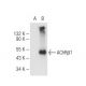 Nicotinic Acetylcholine Receptor beta 1/CHRNB1 Antibody (A-2) - Western Blotting - Image 84099