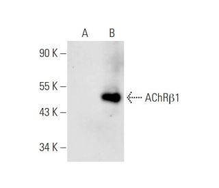 Nicotinic Acetylcholine Receptor beta 1/CHRNB1 Antibody (E-2) - Western Blotting - Image 63150 