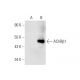 Nicotinic Acetylcholine Receptor beta 1/CHRNB1 Antibody (E-2) - Western Blotting - Image 63150 