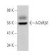 Nicotinic Acetylcholine Receptor beta 1/CHRNB1 Antibody (E-2) - Western Blotting - Image 363984
