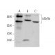 Nicotinic Acetylcholine Receptor delta/CHRND Antibody (137) - Western Blotting - Image 379835 