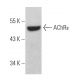 Nicotinic Acetylcholine Receptor epsilon/CHRNE Antibody (D-6) - Western Blotting - Image 366363