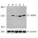 Nicotinic Acetylcholine Receptor epsilon/CHRNE Antibody (D-6) - Western Blotting - Image 414842 