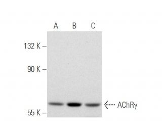 Nicotinic Acetylcholine Receptor gamma/CHRNG Antibody (145) - Western Blotting - Image 137013 