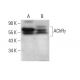 Nicotinic Acetylcholine Receptor gamma/CHRNG Antibody (145) - Western Blotting - Image 382867