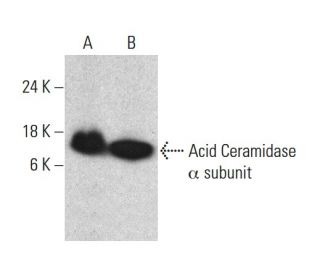 Acid Ceramidase Antibody (23) - Western Blotting - Image 385757 
