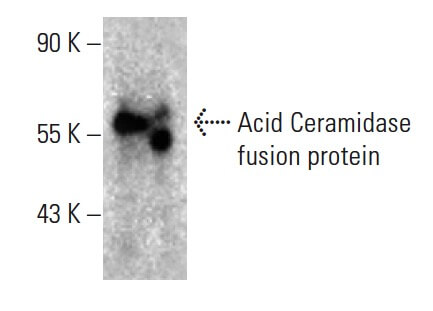 らいしページ acid-ceramidase-antibody-23-