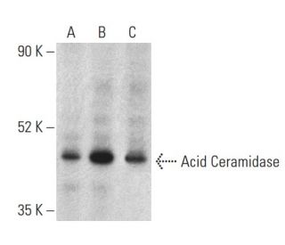 Acid Ceramidase Antibody (F-9) - Western Blotting - Image 399405