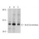 Acid Ceramidase Antibody (F-9) - Western Blotting - Image 399405