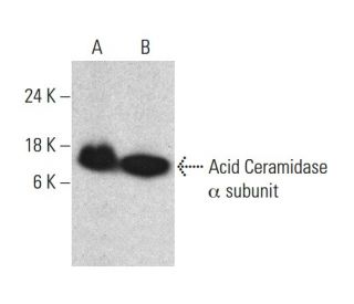 western blotting image from recommended Acid Ceramidase (23) monoclonal antibody replacement. Image 385757