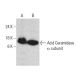 western blotting image from recommended Acid Ceramidase (23) monoclonal antibody replacement. Image 385757