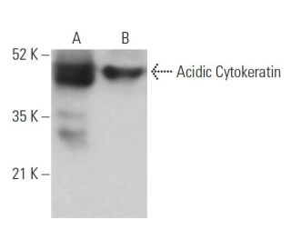 Acidic Cytokeratin Antibody (5F154) - Western Blotting - Image 379265 