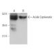 Acidic Cytokeratin Antibody (5F154) - Western Blotting - Image 379265 