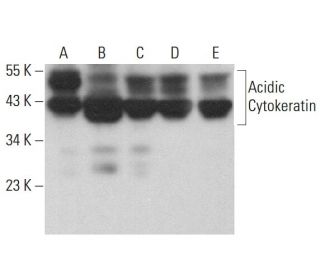 Acidic Cytokeratin Antibody (5F156) - Western Blotting - Image 380525