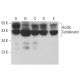 Acidic Cytokeratin Antibody (5F156) - Western Blotting - Image 380525
