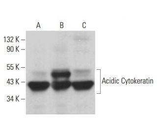 Acidic Cytokeratin Antibody (AE1) - Western Blotting - Image 380854 