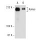 Acinus Antibody (2005C3a) - Western Blotting - Image 146338 