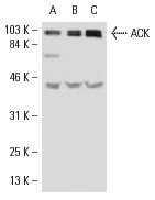 ACK Antibody (A-11) | SCBT - Santa Cruz Biotechnology