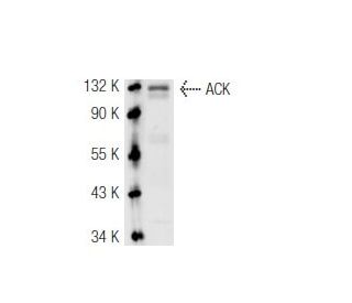 ACK Antibody (A-11)