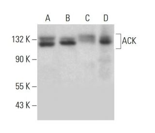 小物 aks LHX6 Antibody (A-9) | SCBT - Santa Cruz Biotechnology