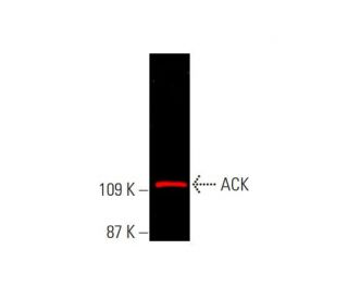 ACK Antibody (A-11)