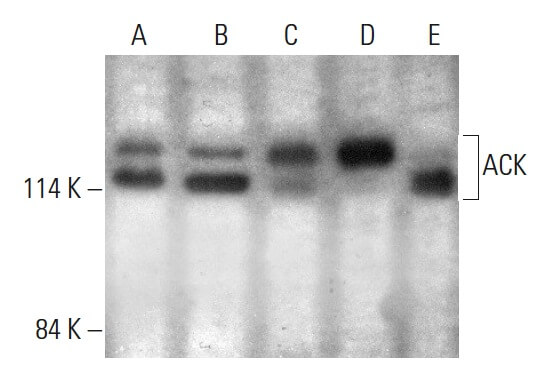 ACK Antibody (A-11) | SCBT - Santa Cruz Biotechnology