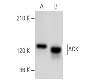 western blotting image from recommended ACK (A-11) monoclonal antibody replacement. Image 354953