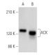 western blotting image from recommended ACK (A-11) monoclonal antibody replacement. Image 354953