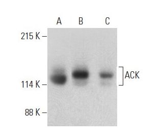 ACK Antibody (A-11) - Western Blotting - Image 399128