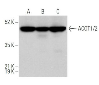 ACOT1/2 Antibody (E-1) - Western Blotting - Image 374632 