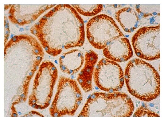 Anti-ACOT1/2 Antibody (F-2) | SCBT - Santa Cruz Biotechnology