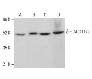 Anti-ACOT1/2 Antibody (F-2) | SCBT - Santa Cruz Biotechnology