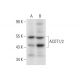 ACOT1/2 Antibody (F-6) - Western Blotting - Image 305847