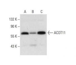 ACOT11 Antibody (D-4) - Western Blotting - Image 308186 