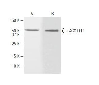 ACOT11 Antibody (J4B2) - Western Blotting - Image 62764