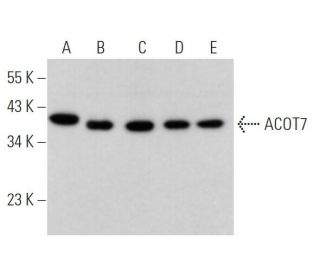 ACOT7 Antibody (B-4) - Western Blotting - Image 366045 