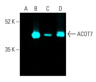 ACOT7 Antibody (C-2) - Western Blotting - Image 401815 