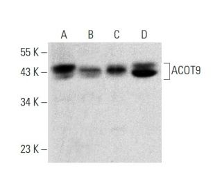 ACOT9 Antibody (G-6) | SCBT - Santa Cruz Biotechnology