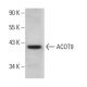 ACOT9 Antibody (G-6) - Western Blotting - Image 376419 