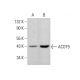 ACOT9 Antibody (G-6) - Western Blotting - Image 384376