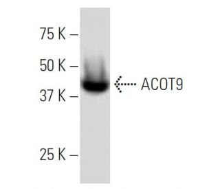 ACOT9 Antibody (O59) - Western Blotting - Image 33848 