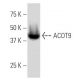 ACOT9 Antibody (O59) - Western Blotting - Image 33848 