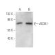 western blotting image from recommended ACOX1 (153CT43.1.1) monoclonal antibody replacement. Image 374575